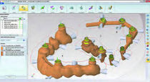 CAD / CAM software for dental prosthese machining WorkNC DENTAL SESCOI