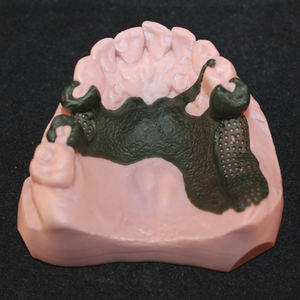 polymer 3D printing resin / dental