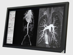 LCD display / housed / for medical applications / medical