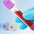 liquid chromatograph - toxtyper