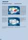 MENTOR Keypad components and accessories