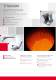 Titanium  Vacuum Precision  Casting - ALD