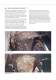 Overview Brochure Screenings Treatment