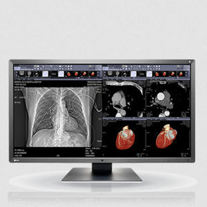 IPS LCD monitor 1