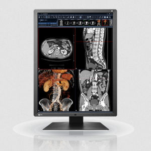 IPS LCD monitor 1