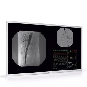 IPS display 1