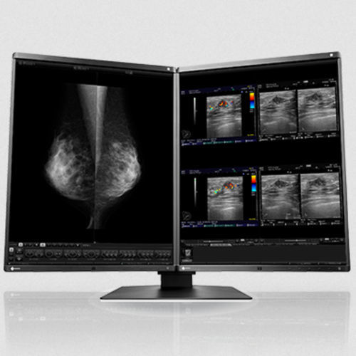 IPS LCD monitor - RX560 series - EIZO NANAO - LED backlight / medical / 21.3"