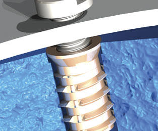 Threaded insert - Foamsert® - TAPPEX - brass / flat