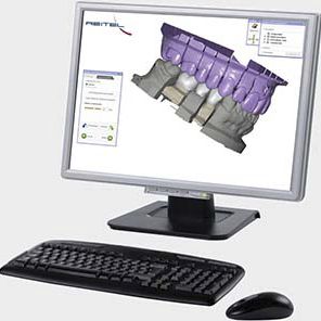 Interface software - exocad  - Reitel - design / planning / dental