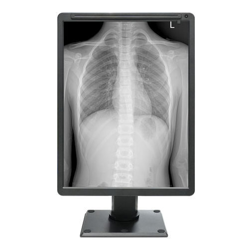 Medical display panel - MDC-G2201 - ZRT Technology - monochrome / 21.3" / HDMI