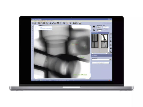 Analysis software - VISTAPLUS V - Waygate Technologies - X-ray image visualization / image acquisition / data archiving