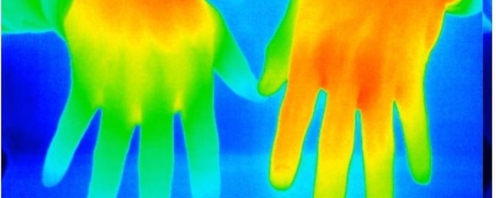 Innovative Thermography for Human Skin Temperature Measurement