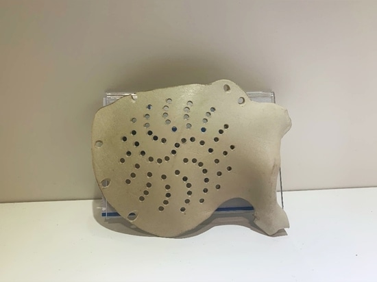 3D Printed PEEK Cranial Plates by PPBF Technology