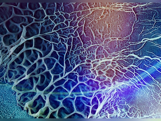 A leading university research lab uses Zygo™ Optical Profilers for faster, more detailed  biofilm insights