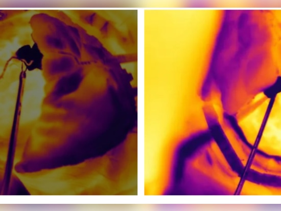 Infrared Thermal Imagers Used in Medical and Health Monitoring