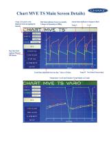 MVE Touch Screen controller overview - 6