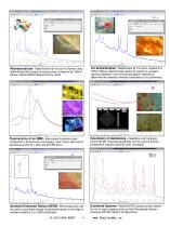 Stellar SCOPE Systems for Microscopy - 2