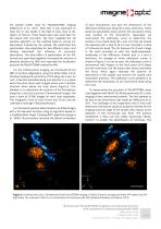 3D dual-color PALM/dSTORM imaging of centrosomal proteins with nanometric resolution using MicAO 3DSR - Adaptive optics for microscopy Application Notes - 4