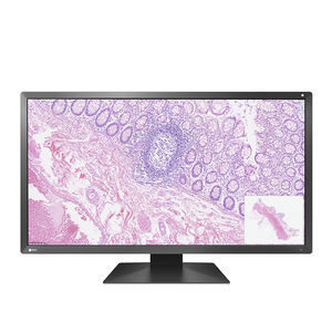 monitor LCD