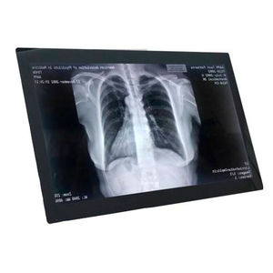 monitor para uso médico