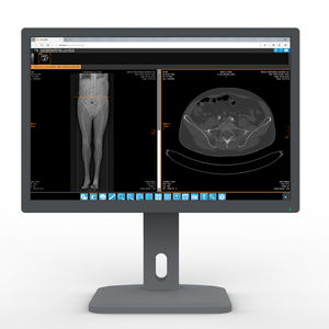monitor para aplicações médicas